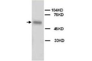 Western Blot analysis of ALPL expression from HeLa cell lyate with ALPL polyclonal antibody . (ALPL Antikörper  (N-Term))