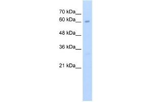 WB Suggested Anti-KIAA0859 Antibody Titration:  2. (METTL13 Antikörper  (C-Term))