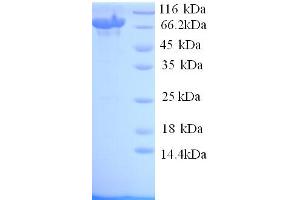 SDS-PAGE (SDS) image for Toll-Like Receptor 8 (TLR8) (AA 27-827) protein (His tag) (ABIN5713898) (TLR8 Protein (AA 27-827) (His tag))