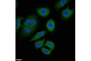 Immunofluorescent analysis of A549 cells using ABIN7144908 at dilution of 1:100 and Alexa Fluor 488-congugated AffiniPure Goat Anti-Rabbit IgG(H+L) (ABCC9 Antikörper  (AA 560-669))