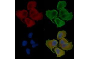 ABIN6260022 and ABIN6276440 staining Hela cells(30 min of UV treatment) by IF/ICC. (ARF6 Antikörper  (Internal Region))