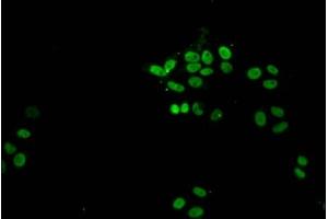 Immunofluorescent analysis of HepG2 cells (sodium butyrate, 30 mM, 4h) using ABIN7139172 at dilution of 1:100 and Alexa Fluor 488-congugated AffiniPure Goat Anti-Rabbit IgG(H+L) (Histone H1.1 Antikörper  (acLys21))