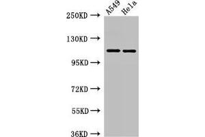 Western Blot Positive WB detected in: A549 whole cell lysate, Hela whole cell lysate All lanes: EPHA5 antibody at 3 μg/mL Secondary Goat polyclonal to rabbit IgG at 1/50000 dilution Predicted band size: 115, 113, 108 kDa Observed band size: 115 kDa (EPH Receptor A5 Antikörper  (AA 246-514))