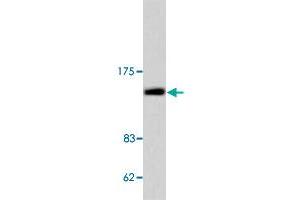 Western blot analysis of COL2A1 polyclonal antibody  in extracts from COLO 205 cell. (COL2A1 Antikörper)