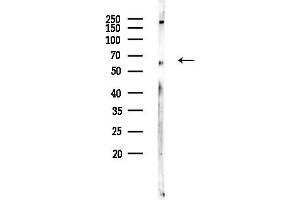 Western blot analysis of lysates from HUVEC cells, using SVOP Antibody at 1/1000 dilution.