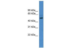 WB Suggested Anti-ZNF277  Antibody Titration: 0. (ZNF277 Antikörper  (N-Term))