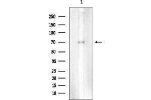 anti-YTH Domain Family, Member 3 (YTHDF3) antibody