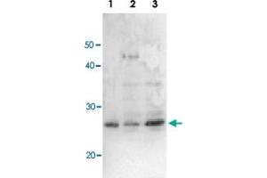 Detection of RuvA (22kD) protein by Western blotting using this antibody. (RuvA Antikörper)