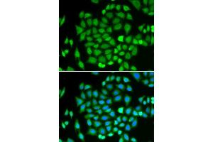 Immunofluorescence analysis of HeLa cells using AKR7A2 antibody. (AKR7A2 Antikörper  (AA 100-359))