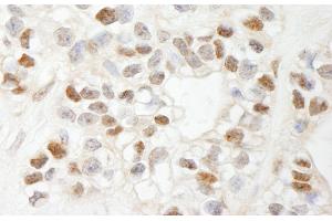 Immunohistochemistry (IHC) image for anti-Chemokine (C-C Motif) Ligand 2 (CCL2) (AA 25-100) antibody (ABIN7449398)