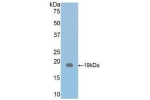 Detection of Recombinant THBS1, Mouse using Polyclonal Antibody to Thrombospondin 1 (THBS1) (Thrombospondin 1 Antikörper  (AA 515-671))
