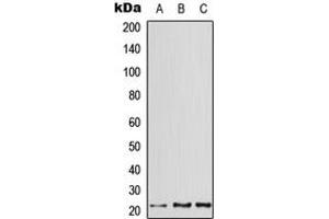 Western blot analysis of ATF3 expression in HeLa (A), mouse heart (B), rat heart (C) whole cell lysates.