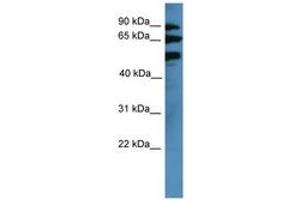 Image no. 1 for anti-Bardet-Biedl Syndrome 2 (BBS2) (AA 315-364) antibody (ABIN6746662) (BBS2 Antikörper  (AA 315-364))