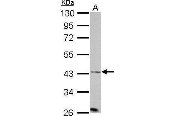 Aurora A Antikörper  (C-Term)