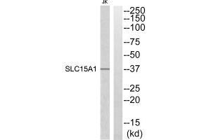 Western blot analysis of extracts from Jurkat cells, using SLC15A1 antibody. (SLC15A1 Antikörper  (Internal Region))