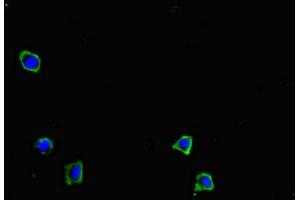 Immunofluorescent analysis of HepG2 cells using ABIN7149644 at dilution of 1:100 and Alexa Fluor 488-congugated AffiniPure Goat Anti-Rabbit IgG(H+L) (GRID2IP Antikörper  (AA 35-156))