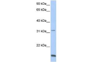 WB Suggested Anti-TCAP Antibody Titration:  0. (TCAP Antikörper  (N-Term))