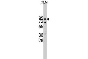 Western blot analysis of CDH10 polyclonal antibody  in CEM cell line lysates (35 ug/lane). (CDH10 Antikörper  (N-Term))