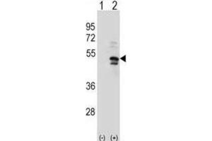 Western Blotting (WB) image for anti-Ubiquitin Specific Peptidase 14 (USP14) antibody (ABIN3001476)