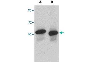 Western blot analysis of SKA3 in human testis tissue lysate with SKA3 polyclonal antibody  at (A) 0. (SKA3 Antikörper  (C-Term))