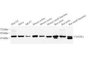 Western blot analysis of CYPIW1 (ABIN7073674) at dilution of 1: 1000 (CYP2W1 Antikörper)