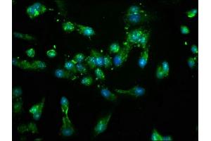 Immunofluorescence staining of Hela cells with ABIN7169102 at 1:100, counter-stained with DAPI. (NEK4 Antikörper  (AA 516-661))