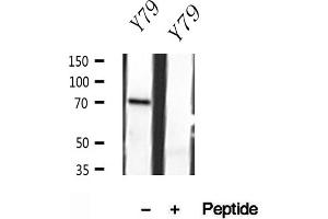 Western blot analysis of extracts of Y79 cells, using MPP5 antibody. (MPP5 Antikörper  (C-Term))