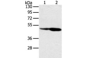 Western Blot analysis of Hepg2 and hela cell using SNX8 Polyclonal Antibody at dilution of 1:400 (SNX8 Antikörper)