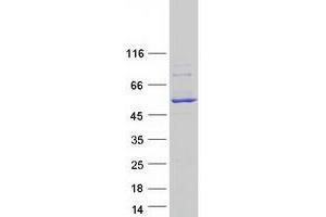 Western Blotting (WB) image for Cytochrome P450, Family 2, Subfamily C, Polypeptide 18 (CYP2C18) (Transcript Variant 1) protein (Myc-DYKDDDDK Tag) (ABIN2712764)