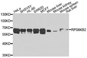 Western blot analysis of extracts of various cell lines, using RPS6KB2 antibody. (RPS6KB2 Antikörper  (AA 1-170))