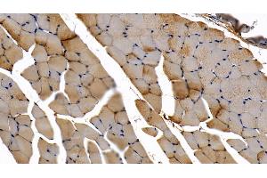 Immunohistochemistry (IHC) image for anti-Myeloid Differentiation Primary Response Gene (88) (MYD88) (AA 32-265) antibody (ABIN7433990)