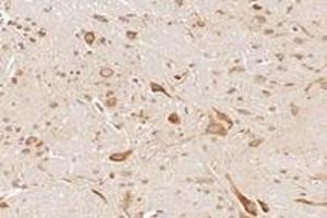Immunohistochemistry (Paraffin-embedded Sections) (IHC (p)) image for anti-NCK Associated Protein 1 (NCKAP1) antibody (ABIN7074784)