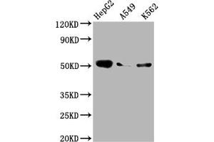 Western Blot Positive WB detected in: HepG2 whole cell lysate, A549 whole cell lysate, K562 whole cell lysate All lanes: Factor IX antibody at 1:2000 Secondary Goat polyclonal to rabbit IgG at 1/50000 dilution Predicted band size: 52 kDa Observed band size: 52 kDa (Rekombinanter Coagulation Factor IX Antikörper)