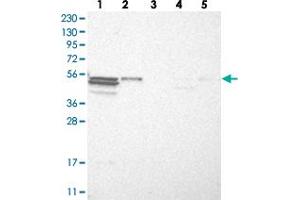 Western blot analysis of Lane 1: RT-4, Lane 2: U-251 MG, Lane 3: Human Plasma, Lane 4: Liver, Lane 5: Tonsil with TRIM11 polyclonal antibody  at 1:250-1:500 dilution. (TRIM11 Antikörper)