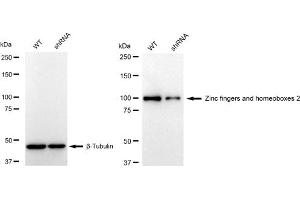 Western blotting analysis using Zinc fingers and homeoboxes 2 antibody (ABIN7800905). (Rekombinanter ZHX2 Antikörper)