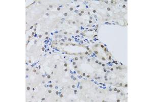Immunohistochemistry of paraffin-embedded mouse kidney using PRPF19 antibody (ABIN5974049) at dilution of 1/100 (40x lens). (PRP19 Antikörper)