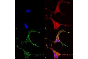 Immunocytochemistry/Immunofluorescence analysis using Mouse Anti-Cav beta 2 Monoclonal Antibody, Clone S8B-1 (ABIN2485029).