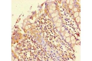 Immunohistochemistry of paraffin-embedded human colon tissue using ABIN7163147 at dilution of 1:100 (PEBP4 Antikörper  (AA 23-227))