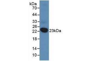 Western blot analysis of recombinant Human DUSP3. (Dual Specificity Phosphatase 3 (DUSP3) (AA 2-185) Antikörper)