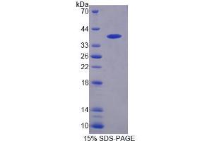 SDS-PAGE analysis of Human PTPN9 Protein.