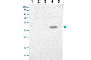 Western blot analysis of Lane 1: RT-4 Lane 2: U-251 MG Lane 3: Human Plasma Lane 4: Liver Lane 5: Tonsil with C3orf33 polyclonal antibody ( Cat # PAB27996 ) at 1:100 - 1:250 dilution. (C3orf33 Antikörper)
