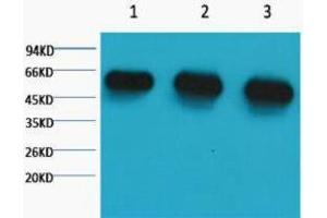 Western Blotting (WB) image for anti-alpha Tubulin (TUBA1) antibody (ABIN3181107) (alpha Tubulin Antikörper)