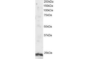 ABIN184801 staining (2µg/ml) of Human Testis lysate (RIPA buffer, 30µg total protein per lane). (ARL4A Antikörper  (N-Term))