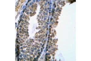 Immunohistochemical analysis of SRY staining in human testis formalin fixed paraffin embedded tissue section. (SRY Antikörper  (Center))