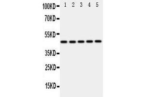 Western Blotting (WB) image for anti-Interferon Regulatory Factor 3 (IRF3) (AA 409-427), (C-Term) antibody (ABIN3043039) (IRF3 Antikörper  (C-Term))