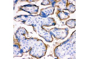 Anti- TFRC antibody,IHC(P) IHC(P): Human Placenta Tissue (Transferrin Receptor Antikörper  (AA 1-198))