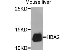 Western blot analysis of extracts of mouse liver cells, using HBA2 antibody. (HBa2 Antikörper)
