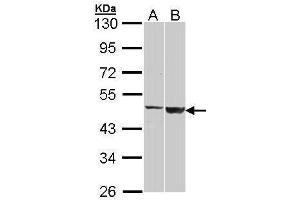 WB Image Sample (30 ug of whole cell lysate) A: H1299 B: Raji 10% SDS PAGE antibody diluted at 1:1000 (GAL3ST1 Antikörper)