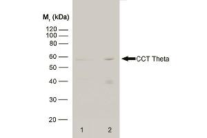 Western blot analysis of HeLa whole cell lysate (1) and HeLa heat stressed whole cell lysate (2) probed with RAT ANTI CCT THETA (ABIN119785) followed by F(ab')2 RABBIT ANTI RAT IgG:HRP (ABIN121399).