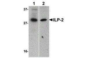 Western Blotting (WB) image for anti-Baculoviral IAP Repeat-Containing 8 (BIRC8) (AA 2-13) antibody (ABIN2475064)